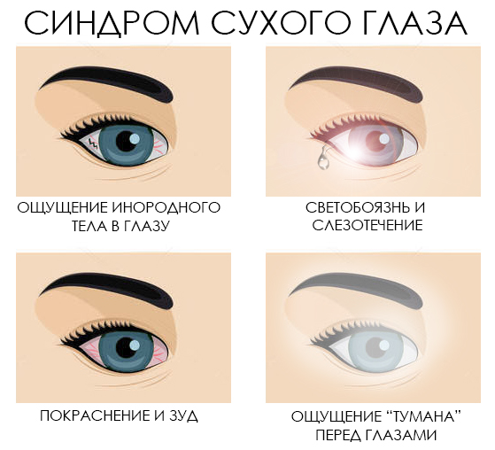 Синдром сухого глаза лечение Екатеринбург.jpg