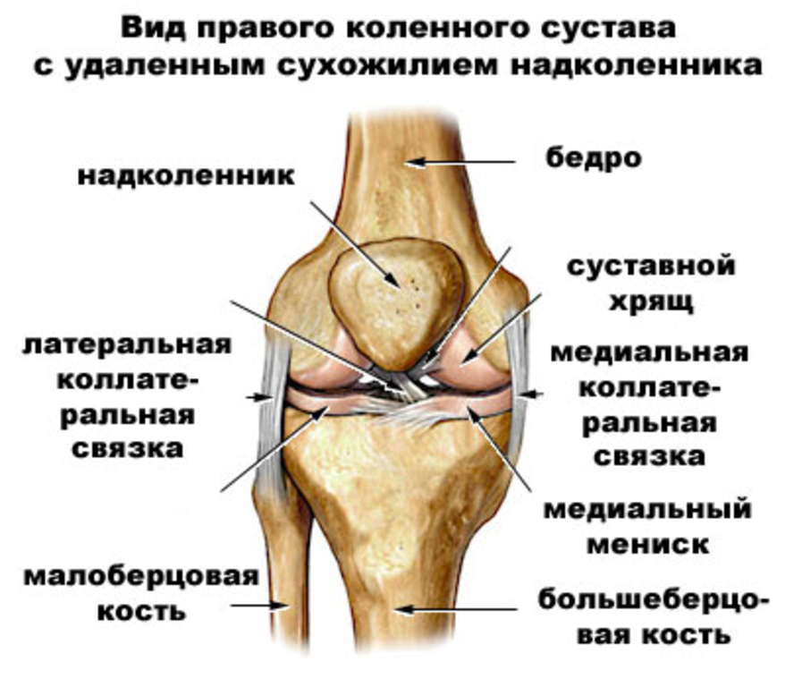 Разрыв менисков коленного сустава.png